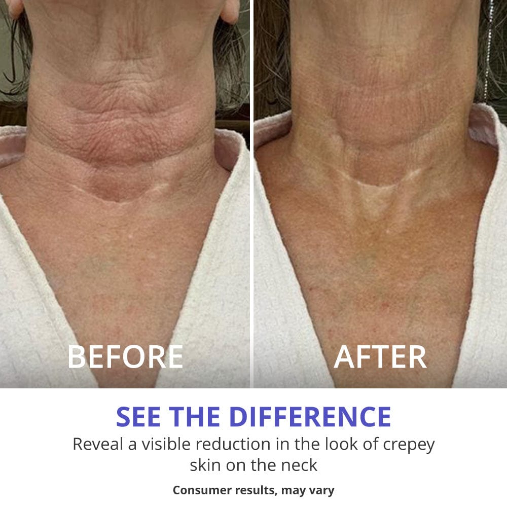 Reclaim Your Youthful Glow with Confidence!